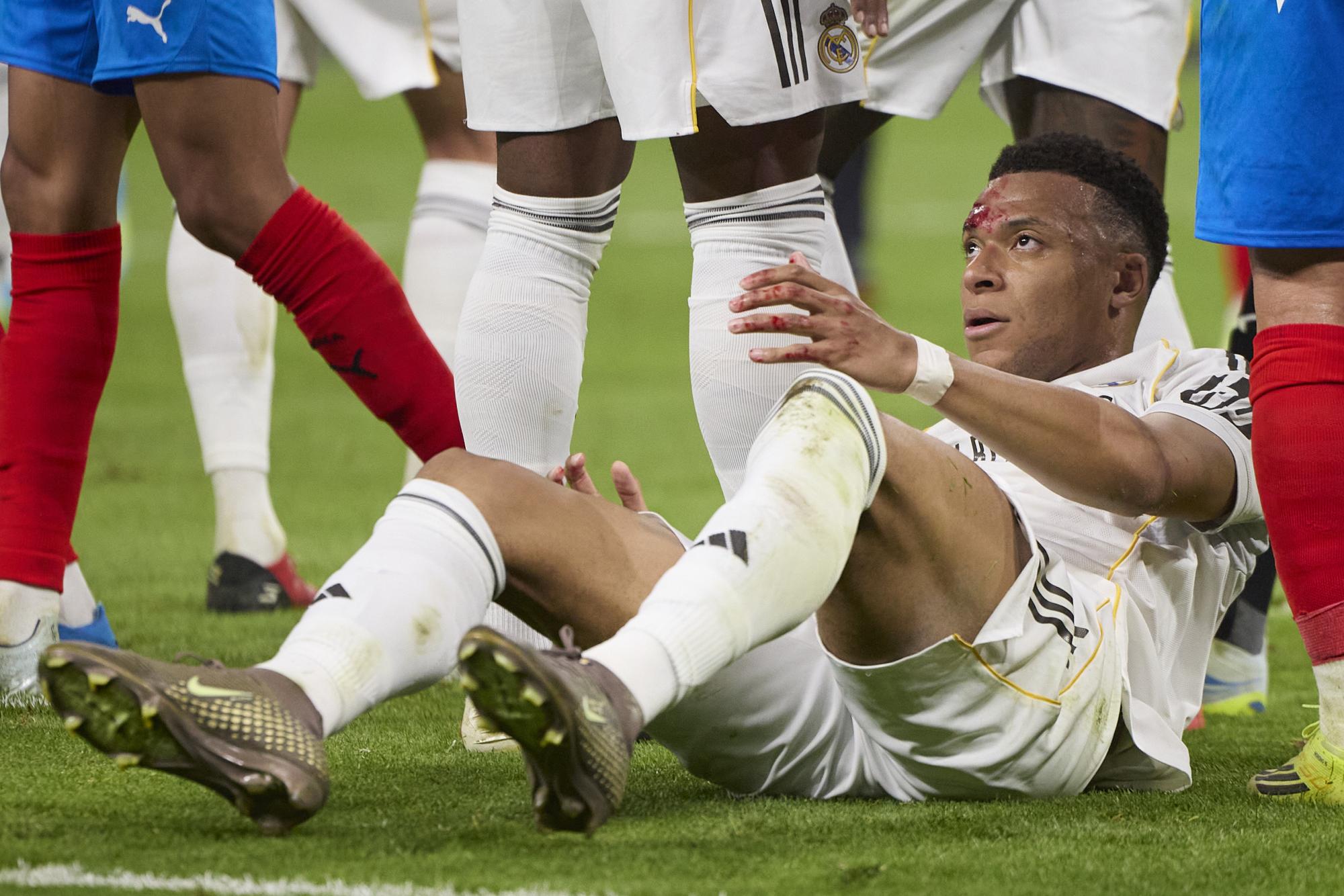 Victime d'un coup de coude et le visage en sang, Kylian Mbappé n'obtient pas de penalty avec le Real Madrid